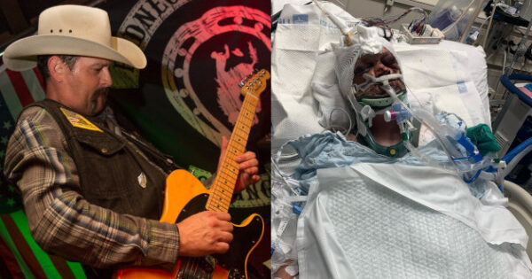Country Guitarist Jay Lawless Brutally Beaten in Attack - Vimarsana News